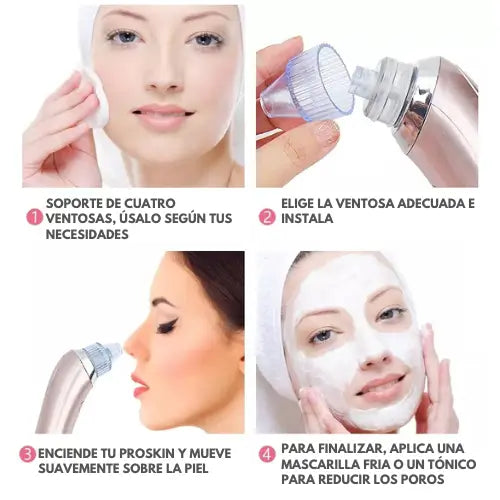 ProSkin | Limpiador facial extractor de espinillas