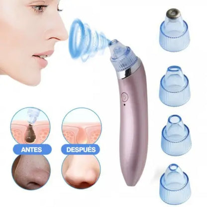 ProSkin | Limpiador facial extractor de espinillas